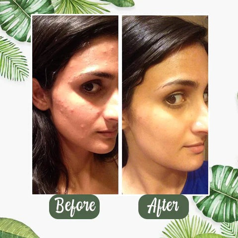 GreenMask™ - mascarilla de limpieza de té verde - 2 unidades