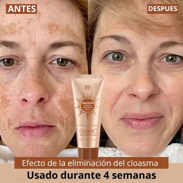 Clarevié™ - Mascarilla facial iluminadora y eliminadora de manchas