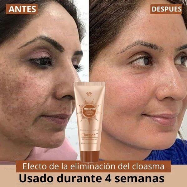 Clarevié™ - Mascarilla facial iluminadora y eliminadora de manchas