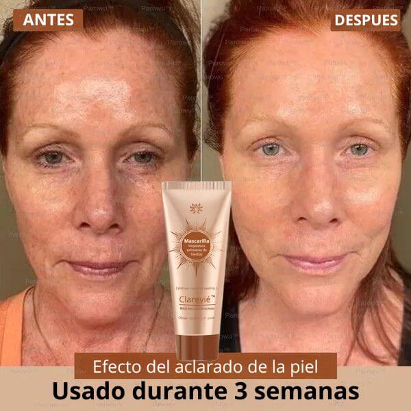 Clarevié™ - Mascarilla facial iluminadora y eliminadora de manchas