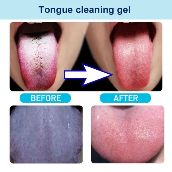 Set de gel + limpiador lingual
