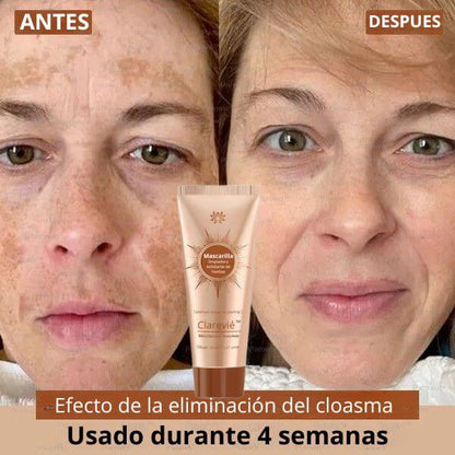 Clarevié™ - Mascarilla facial iluminadora y eliminadora de manchas